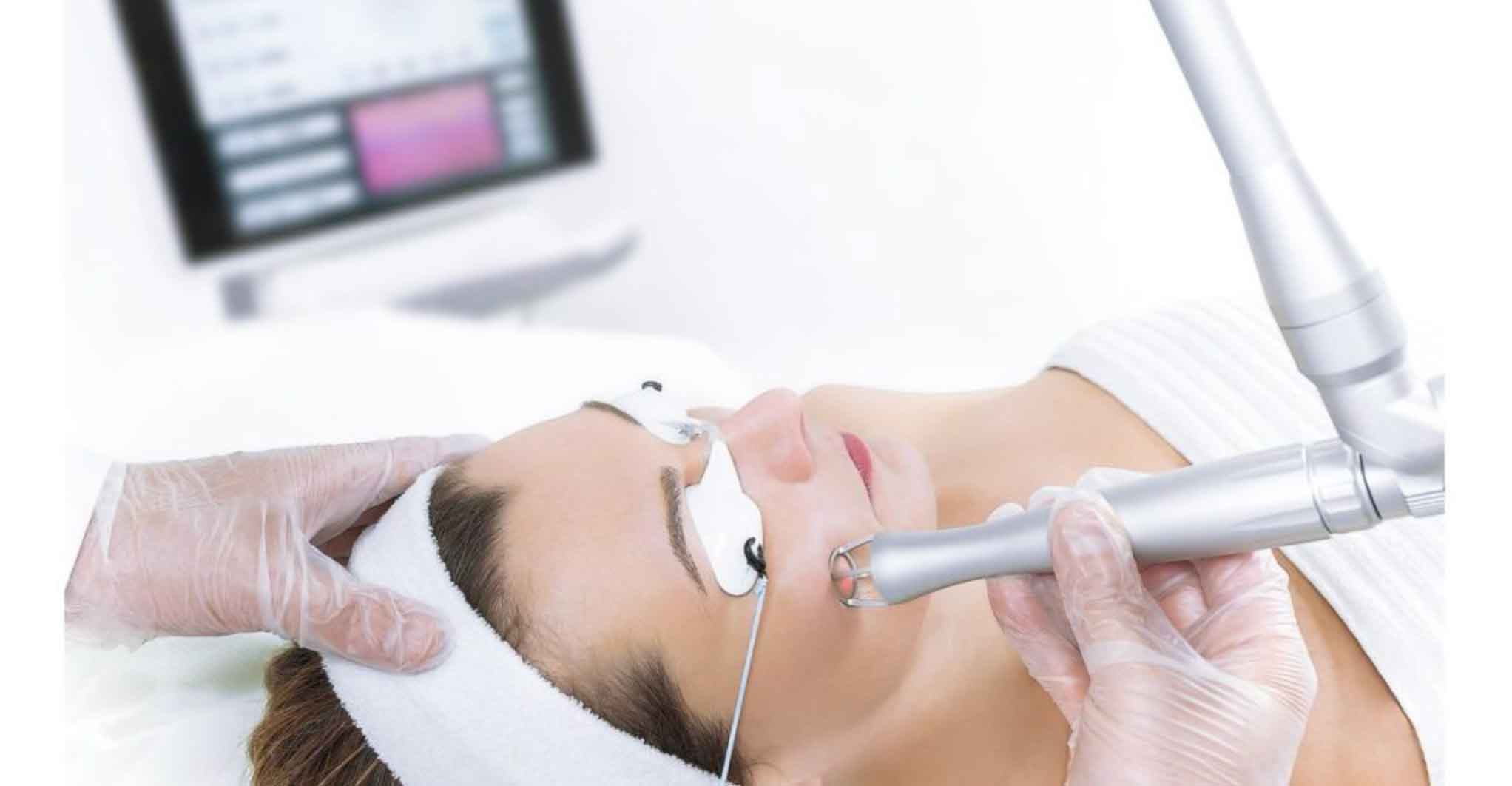 CO2 Laser für dermatologische Laserbehandlungen und Hautabtragung