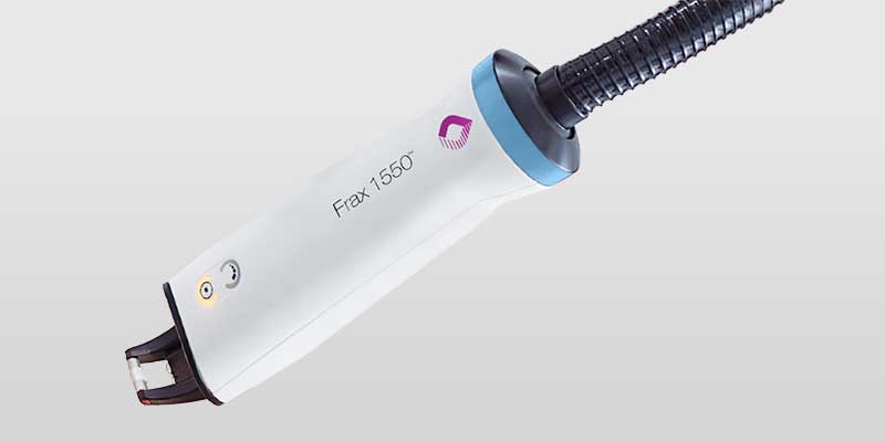 Nordlys Frax 1550 Handstück für fraktionierte nicht-ablative Laserbehandlung