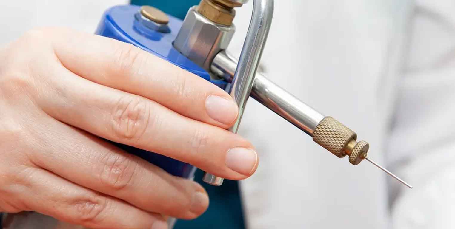 Kryotherapie bei ausgewählten gutartigen Hautveränderungen